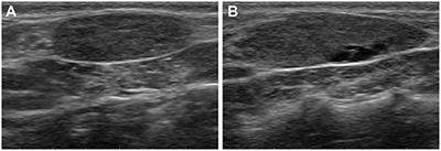 Case Report: Technetium-99m Pertechnetate Scintigraphy Findings in a Dog With Iodine Deficiency-Induced Goitrous Hypothyroidism